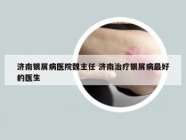 济南银屑病医院魏主任 济南治疗银屑病最好的医生