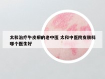 太和治疗牛皮癣的老中医 太和中医院皮肤科哪个医生好