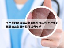 不严重的银屑病公务员体检可以吗 不严重的银屑病公务员体检可以吗知乎