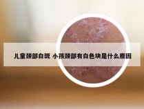 儿童颈部白斑 小孩颈部有白色块是什么原因