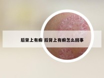 后背上有癣 后背上有癣怎么回事