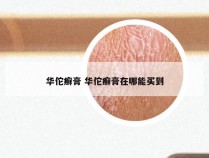 华佗癣膏 华佗癣膏在哪能买到