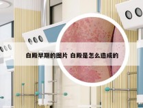 白殿早期的图片 白殿是怎么造成的