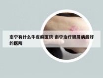 南宁有什么牛皮癣医院 南宁治疗银屑病最好的医院