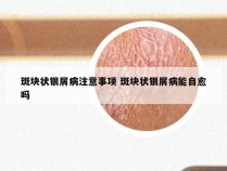 斑块状银屑病注意事项 斑块状银屑病能自愈吗