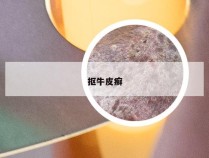 抠牛皮癣