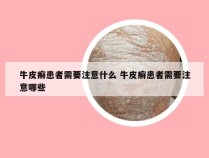 牛皮癣患者需要注意什么 牛皮癣患者需要注意哪些