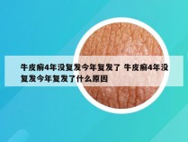 牛皮癣4年没复发今年复发了 牛皮癣4年没复发今年复发了什么原因