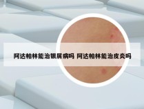 阿达帕林能治银屑病吗 阿达帕林能治皮炎吗