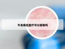 牛皮癣在医疗可以报销吗