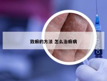 致癣的方法 怎么治癣病