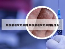 银屑病引发的原因 银屑病引发的原因是什么