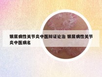银屑病性关节炎中医辩证论治 银屑病性关节炎中医病名