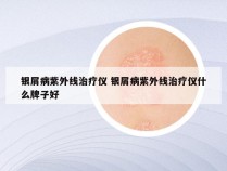 银屑病紫外线治疗仪 银屑病紫外线治疗仪什么牌子好