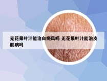无花果叶汁能治白癜风吗 无花果叶汁能治皮肤病吗