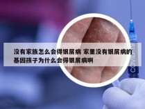 没有家族怎么会得银屑病 家里没有银屑病的基因孩子为什么会得银屑病啊