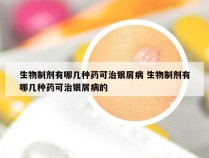 生物制剂有哪几种药可治银屑病 生物制剂有哪几种药可治银屑病的