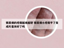银屑病的疙瘩越来越硬 银屑病小疙瘩平了变成片是快好了吗