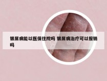 银屑病能以医保住院吗 银屑病治疗可以报销吗