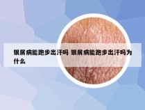 银屑病能跑步出汗吗 银屑病能跑步出汗吗为什么