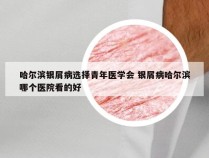 哈尔滨银屑病选择青年医学会 银屑病哈尔滨哪个医院看的好