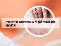 中医治疗银屑病疗效方法 中医治疗银屑病最好的药方