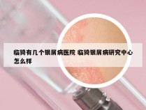 临猗有几个银屑病医院 临猗银屑病研究中心怎么样