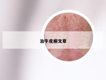 治牛皮癣文章