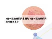 2元一瓶治癣的药水图片 2元一瓶治癣的药水叫什么名字