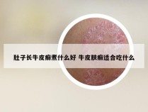 肚子长牛皮癣煮什么好 牛皮肤癣适合吃什么