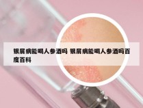 银屑病能喝人参酒吗 银屑病能喝人参酒吗百度百科