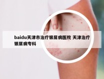 baidu天津市治疗银屑病医院 天津治疗银屑病专科