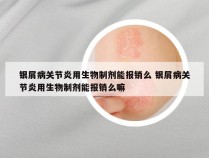 银屑病关节炎用生物制剂能报销么 银屑病关节炎用生物制剂能报销么嘛