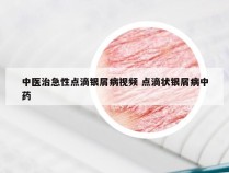 中医治急性点滴银屑病视频 点滴状银屑病中药