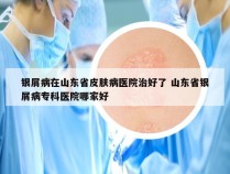 银屑病在山东省皮肤病医院治好了 山东省银屑病专科医院哪家好