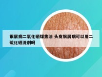 银屑病二氧化硒煤焦油 头皮银屑病可以用二硫化硒洗剂吗