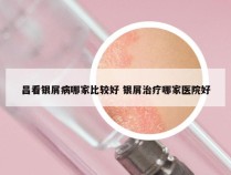 昌看银屑病哪家比较好 银屑治疗哪家医院好