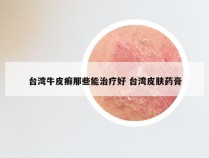 台湾牛皮癣那些能治疗好 台湾皮肤药膏