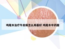 鸡尾木治疗牛皮癣怎么用最好 鸡尾木中药图