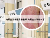 内蒙古大学牛皮癣老师 内蒙古大学牛一丁