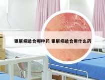 银屑病适合哪种药 银屑病适合用什么药