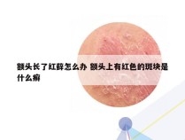 额头长了红藓怎么办 额头上有红色的斑块是什么癣
