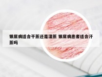 银屑病适合干蒸还是湿蒸 银屑病患者适合汗蒸吗