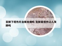 百鲜下塔热片治银肖病吗 百鲜夏塔热让人发胖吗
