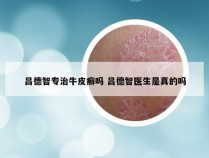 吕德智专治牛皮癣吗 吕德智医生是真的吗