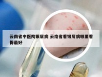 云南省中医院银屑病 云南省看银屑病哪里看得最好