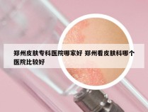 郑州皮肤专科医院哪家好 郑州看皮肤科哪个医院比较好