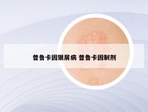 普鲁卡因银屑病 普鲁卡因制剂