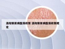 洛阳银屑病医保政策 洛阳银屑病医保政策规定