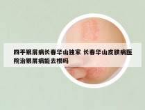 四平银屑病长春华山独家 长春华山皮肤病医院治银屑病能去根吗